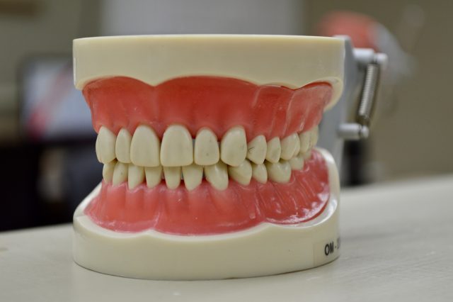 Dental model