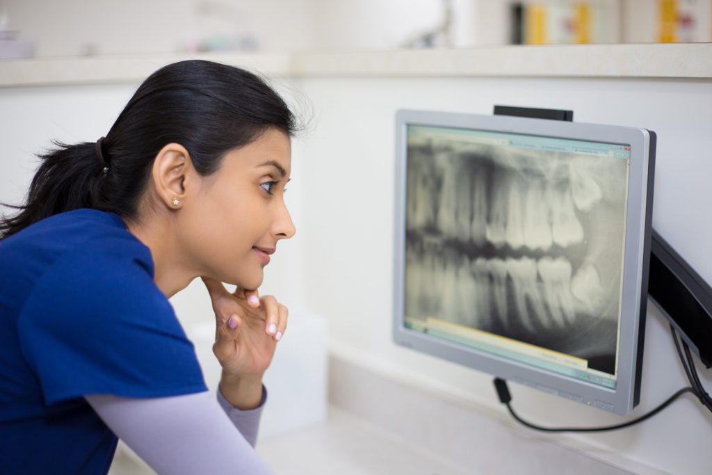 Dental Assistant Setting up X-Ray Films